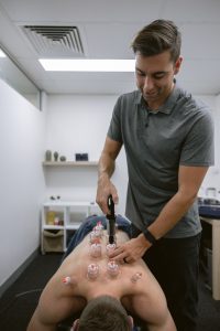 Chiropractor using Cupping Therapy at Impulse Chiropractic